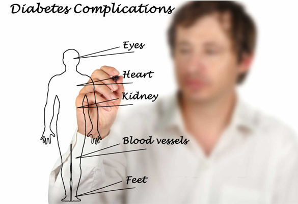 Diabetic complications