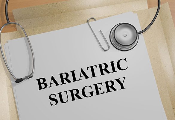 Bariatric surgery