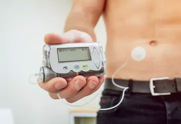 Insulin pump