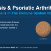 Normal brown skin beside psoriatic skin: a sharply demarcated raised plaque covered in silvery scale. In psoriasis the root cause lies in the immune system, not on the skin.