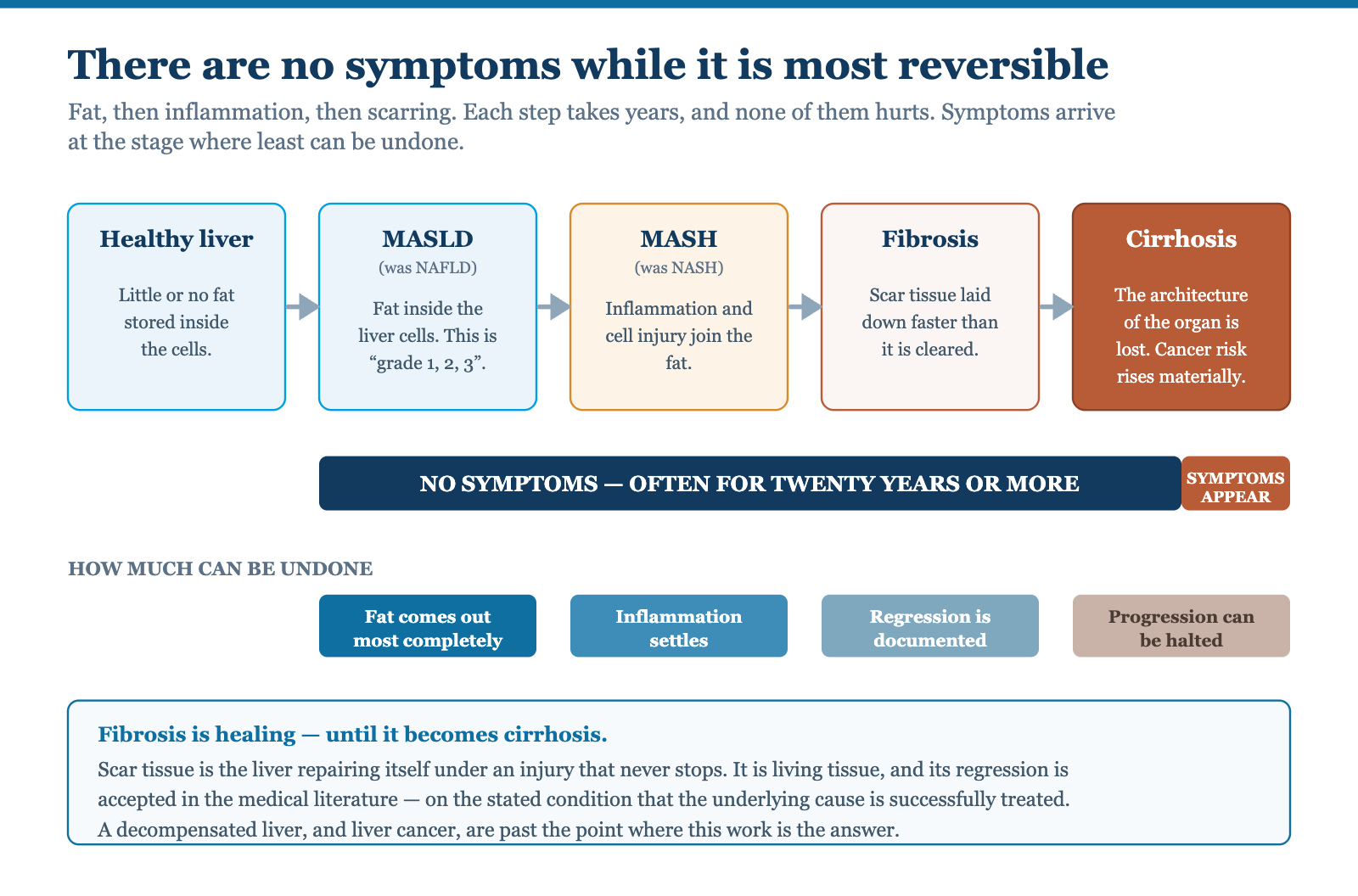 Diagram of the progression from a healthy liver through fat, inflammation, fibrosis and cirrhosis to raised cancer risk, showing that the disease is symptom-free during the years in which it is most reversible