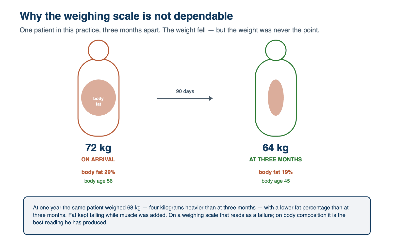 One patient shown at 68 kg with visceral fat 12 and at 56 kg with visceral fat 4.5 three months later, with muscle mass increased.
